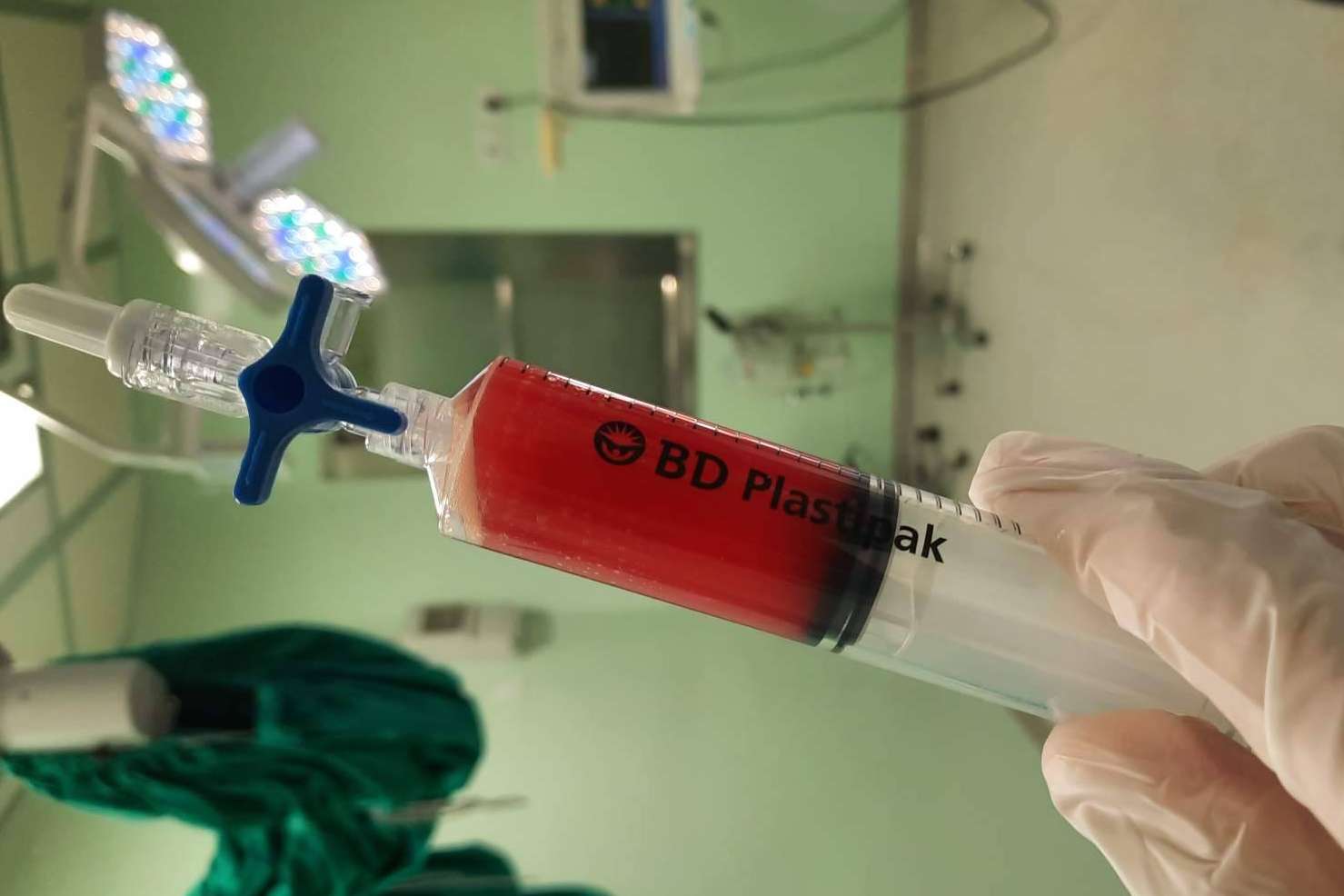 Dolor de hombro; tratamiento eficaz con plasma rico en plaquetas y células madre, en Biorigenera