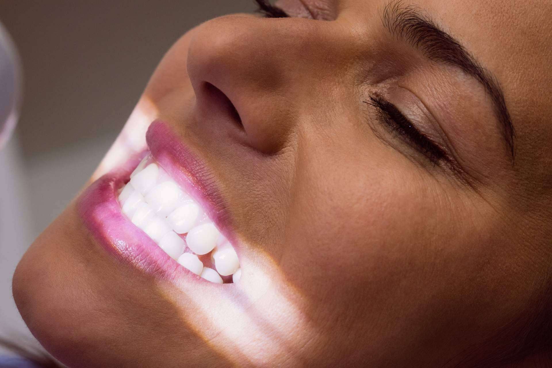 Logra una sonrisa blanca y sana este verano con los tratamientos de estética dental en tendencia