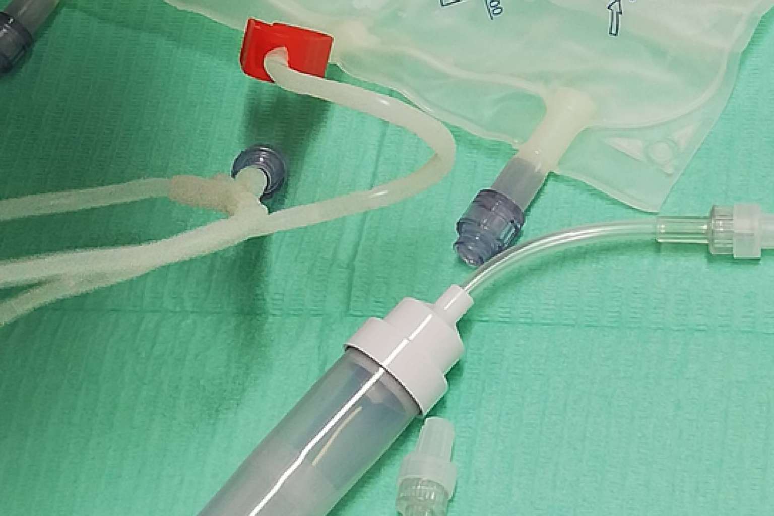 Las ventajas médicas de la Ozonoterapia en Clínica Biorigenera