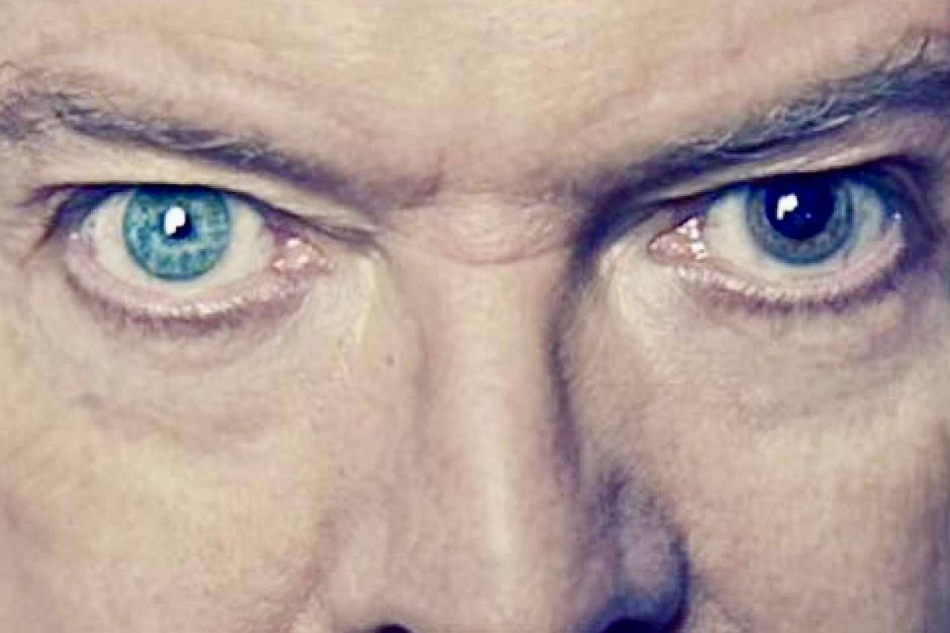 Personajes famosos con heterocromía ocular