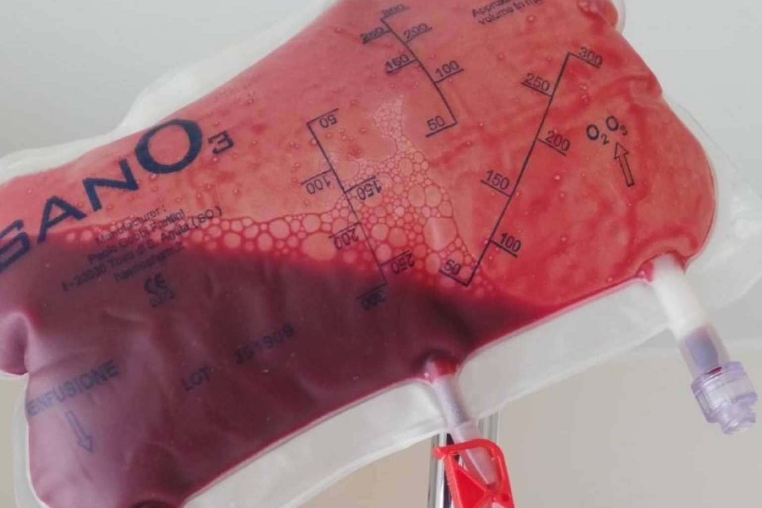 Tratar los trastornos de la diabetes con ozonoterapia es posible con Biorigenera