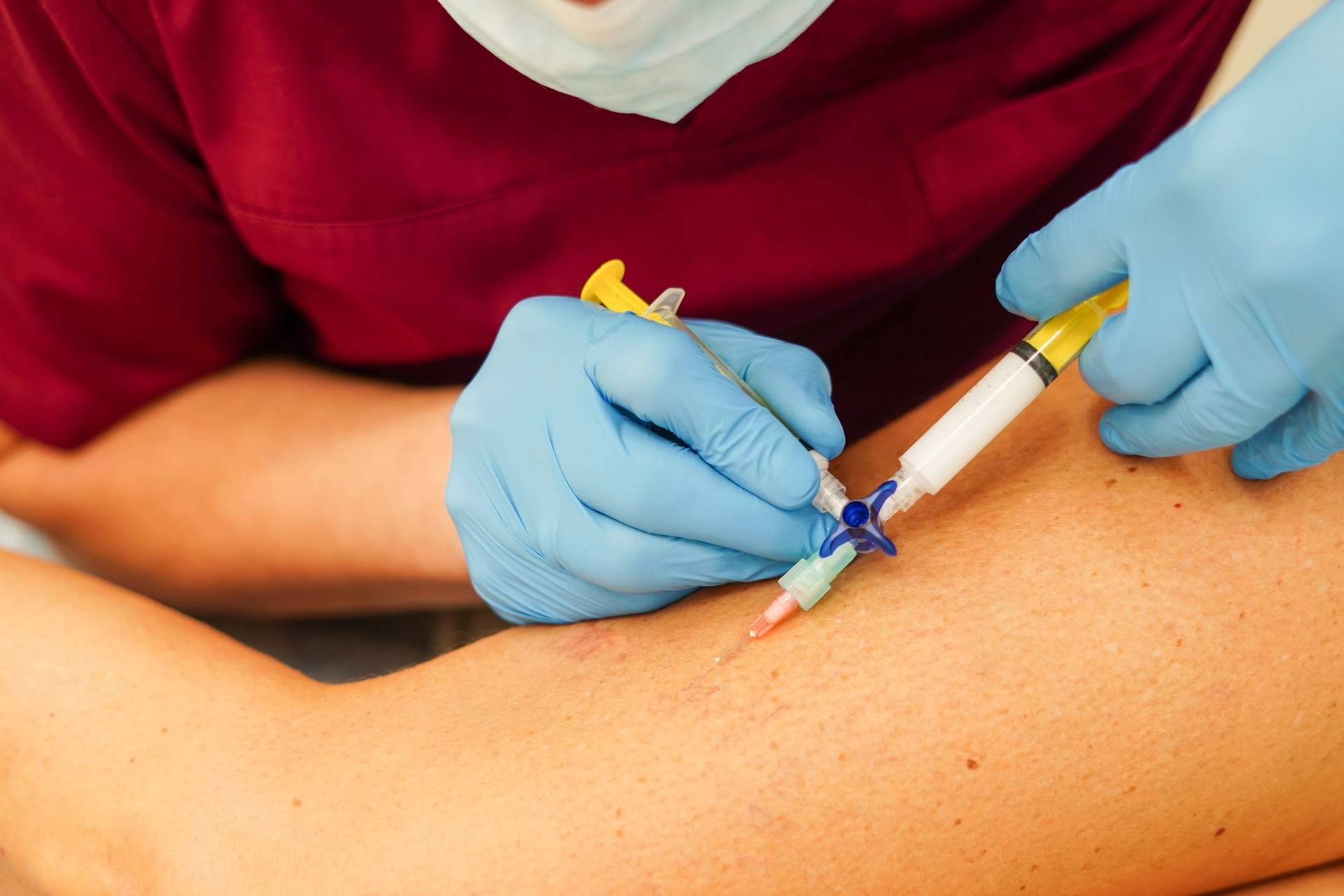 Centro especializado en eliminación de varices en Madrid