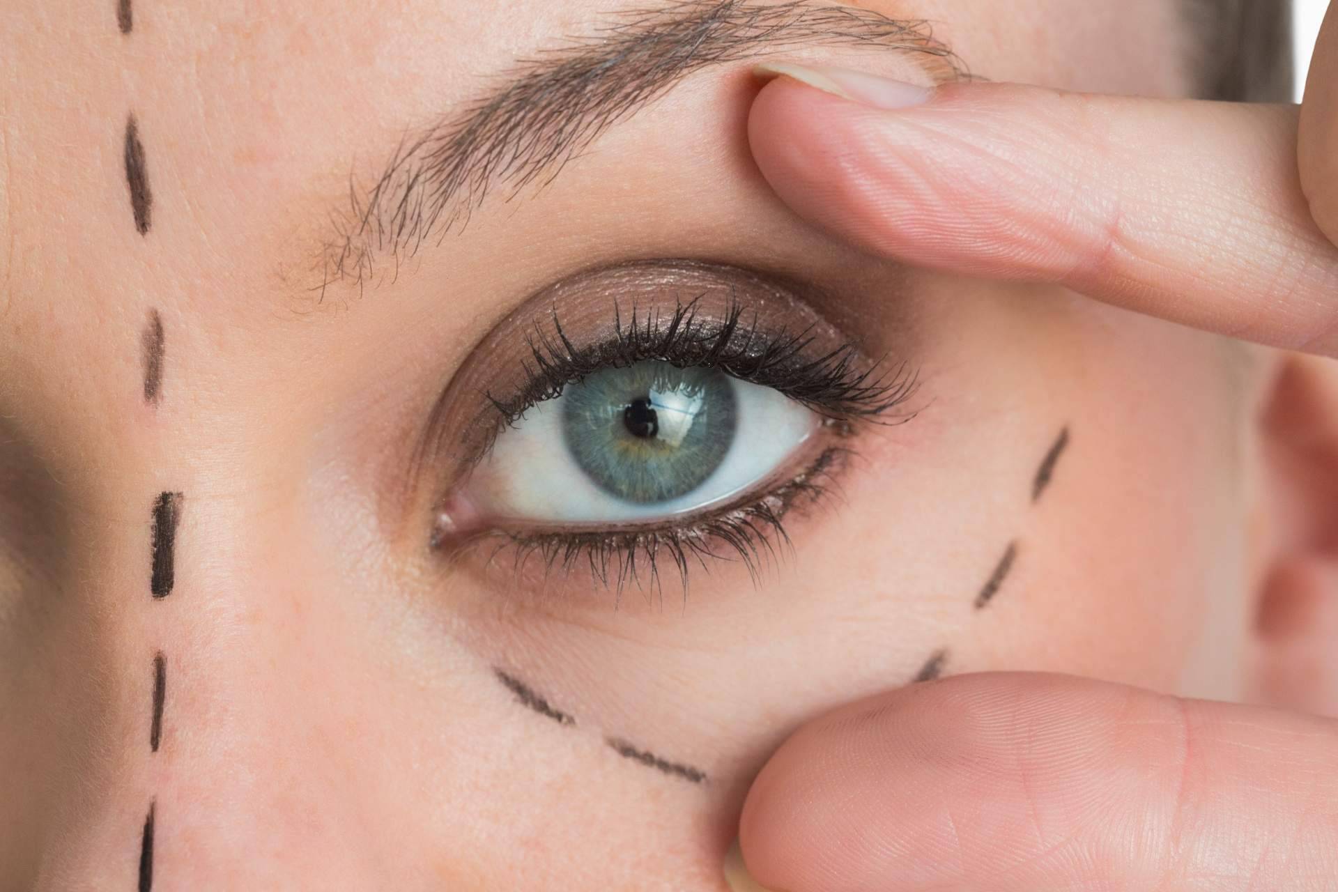 Blefaroplastia, el tratamiento moderno para rejuvenecer la mirada y mejorar el bienestar general