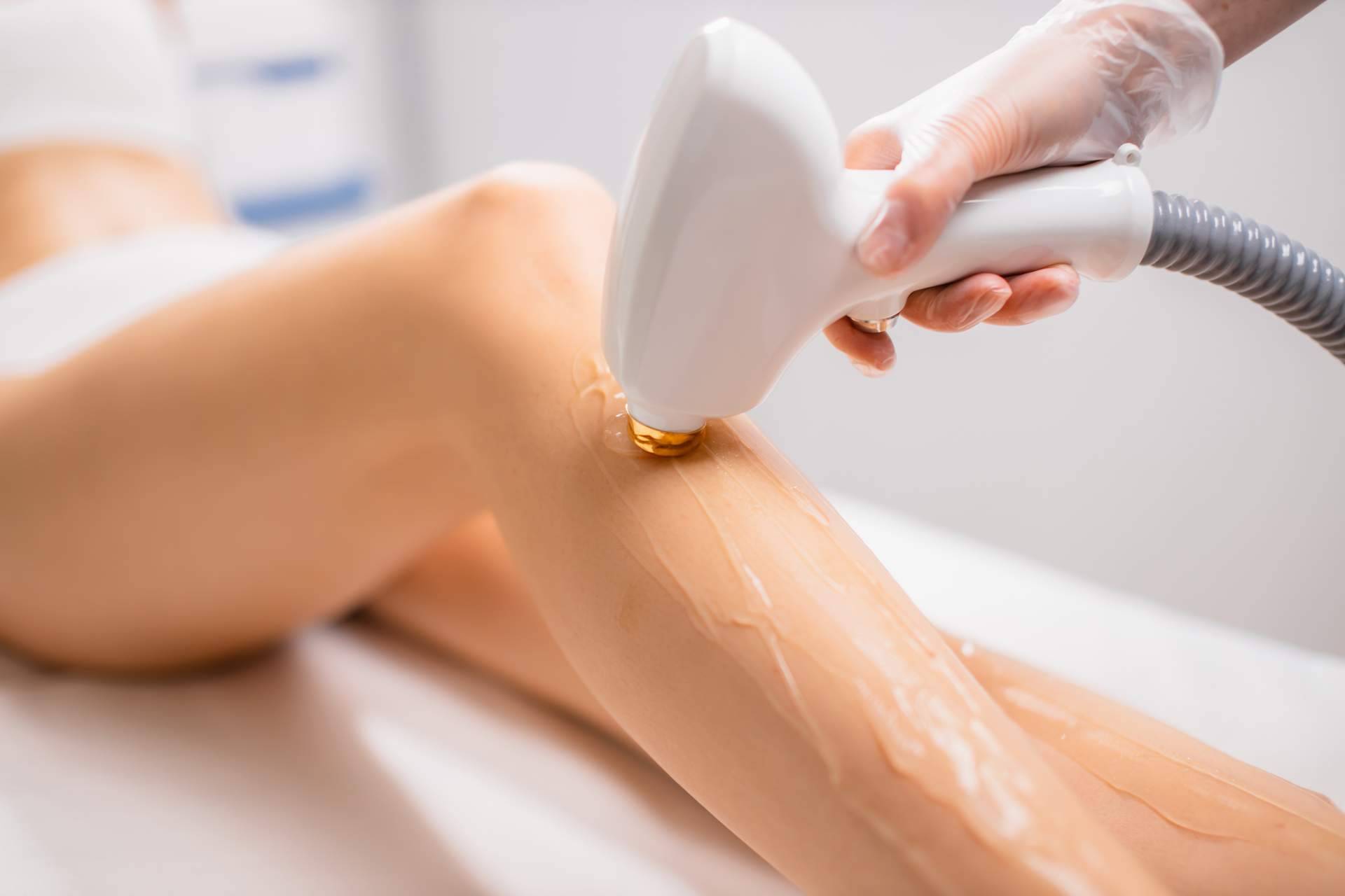 Tratamientos seguros y efectivos de depilación láser para piernas, con los profesionales de 360Clinics