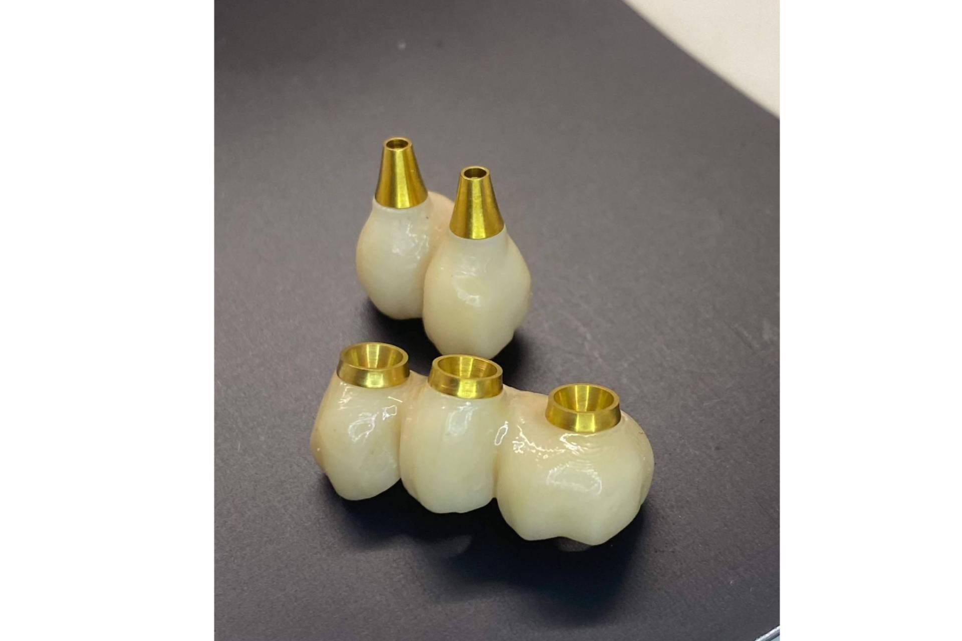Implantes en el día con tecnología 3D en la sonrisa, de la mano de Dentinova
