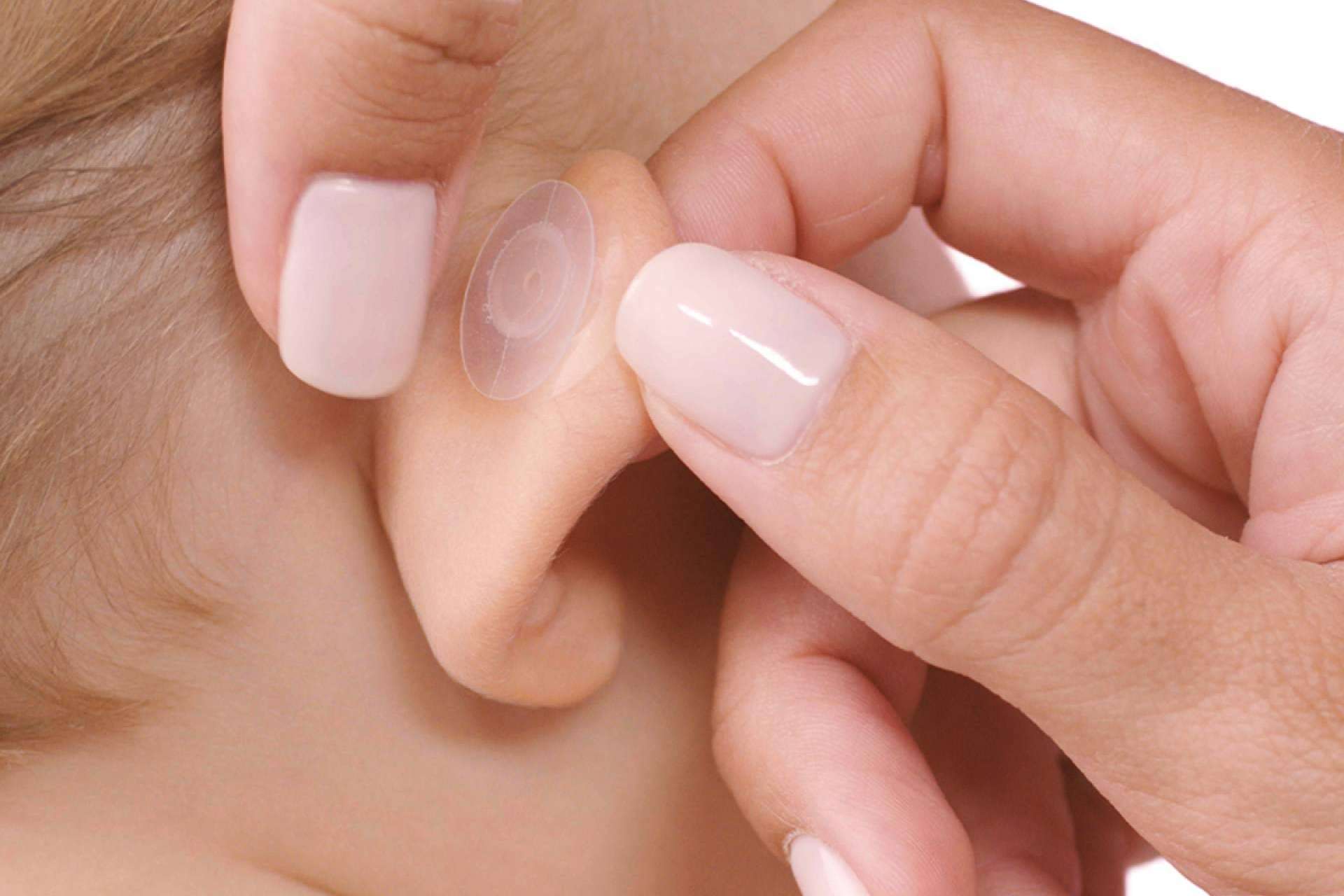 Otostick Bebé, el producto español que corrige las orejas de soplillo en bebés y niños