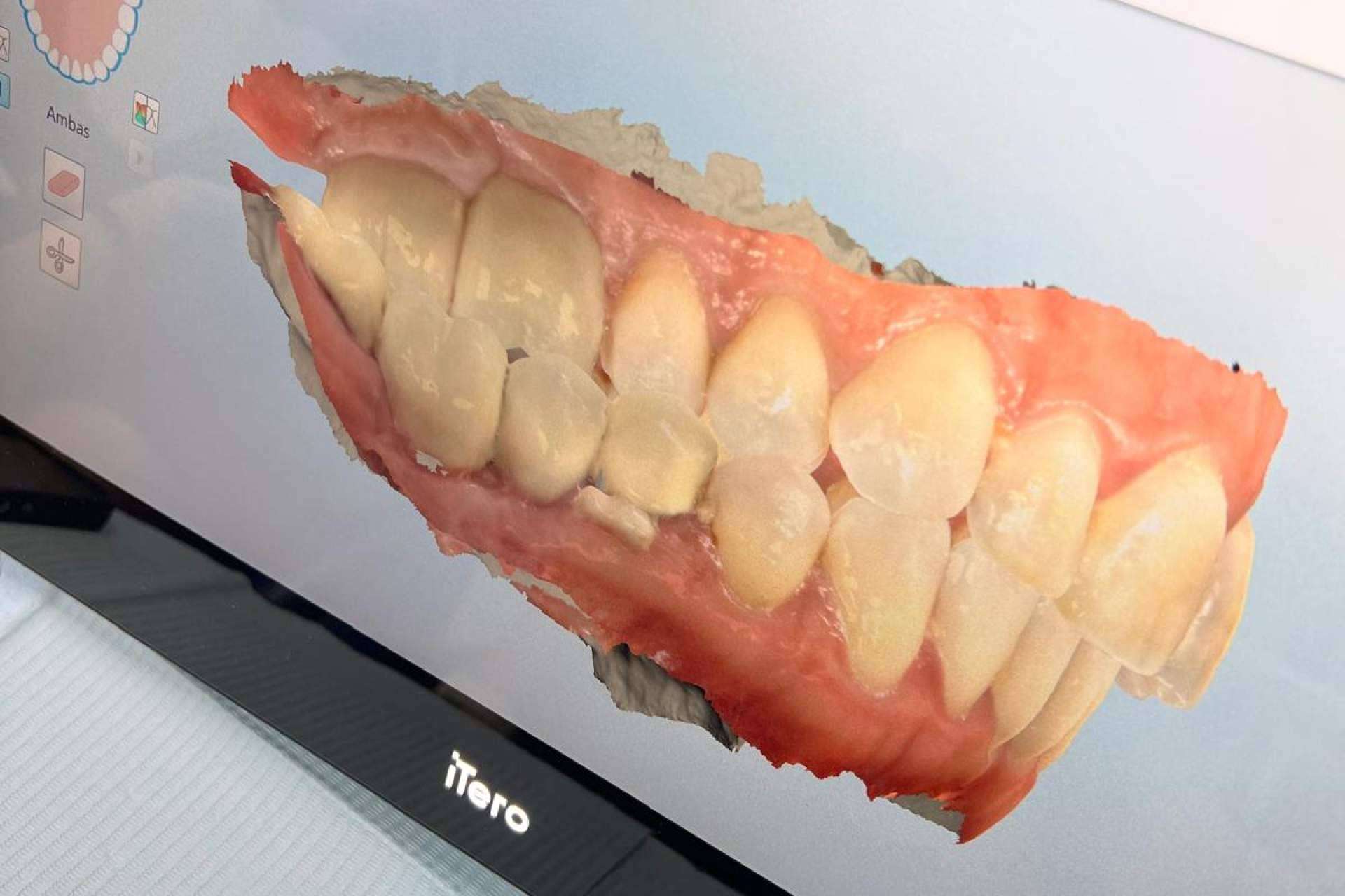 Clínicas Nobel transforma el diagnóstico dental con simulaciones avanzadas en tiempo real