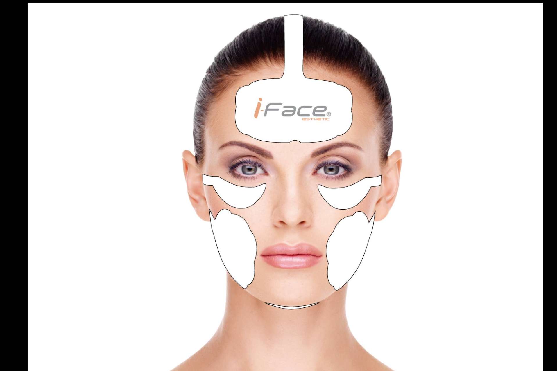 I-FACE esthetic es el lifting facial sin cirugía, rápido y natural