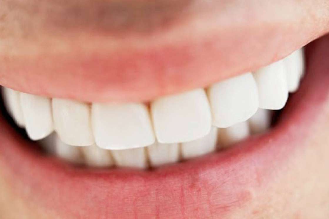 Madrid confía en Clínica Jorge del Corral para implantes dentales de excelencia