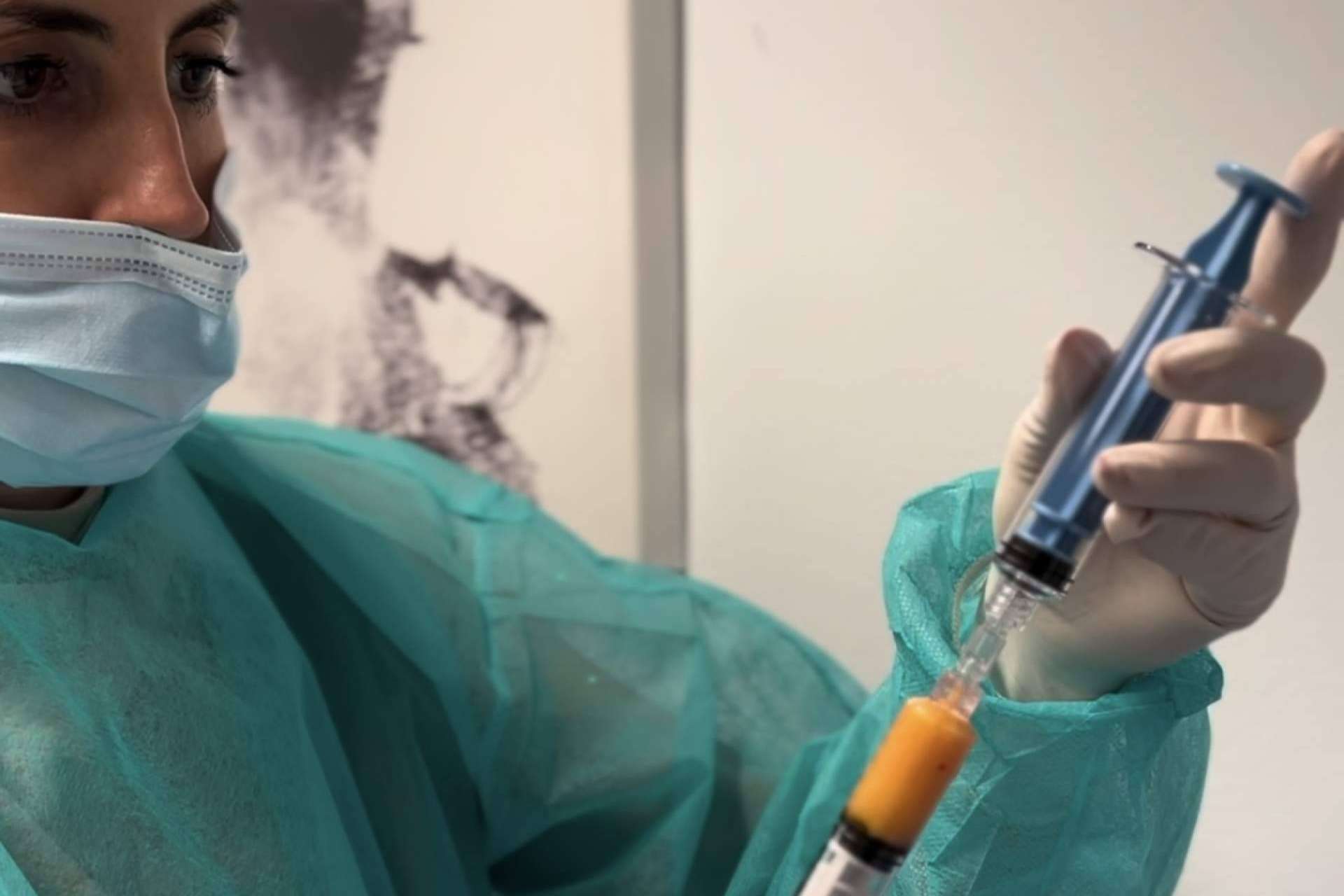 SEFFILLER®️ llega a MD Cliniques; regeneración cutánea con tejido graso propio