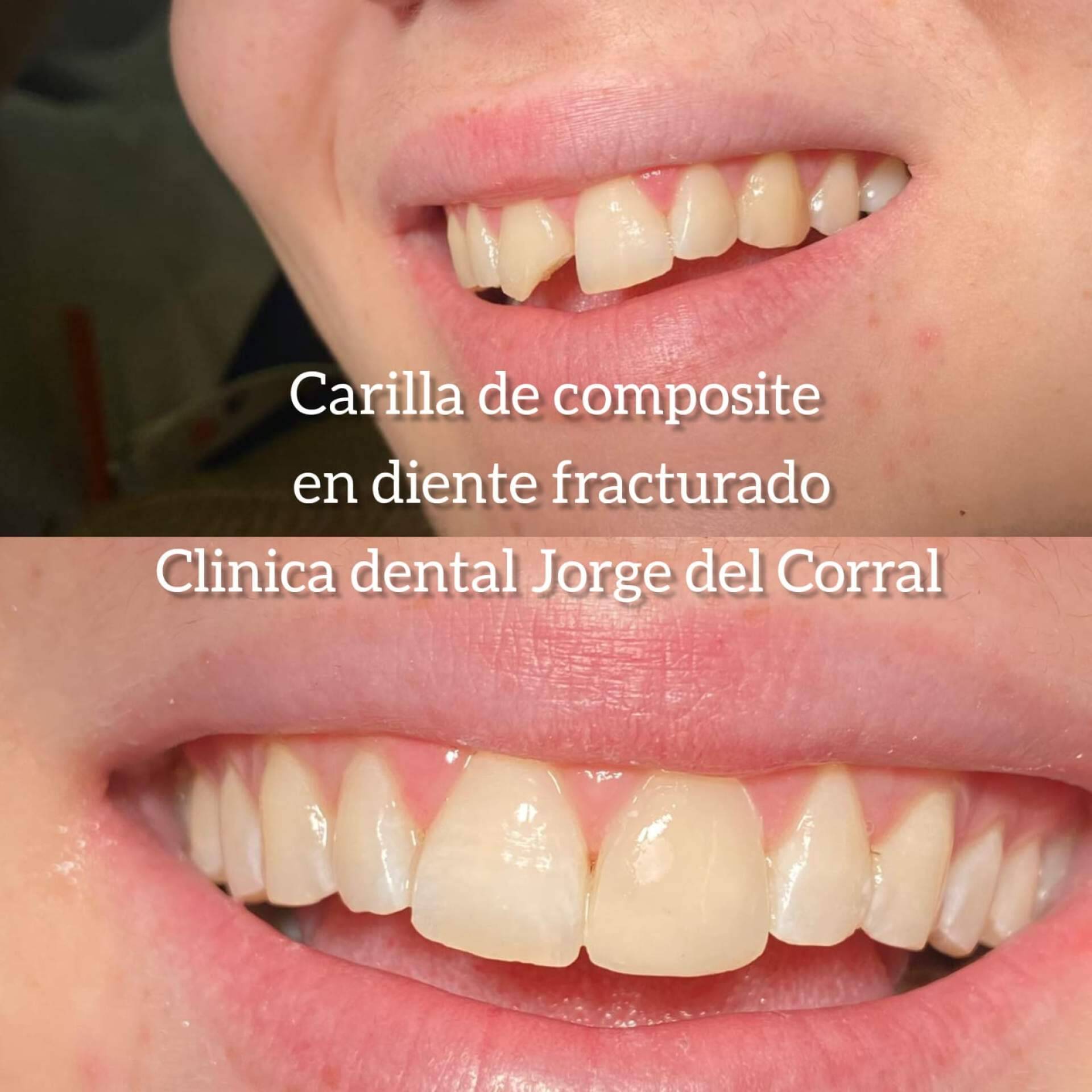 Estética dental de vanguardia con implantes, carillas, prótesis y ortodoncia en la Clínica Dental Jorge del Corral