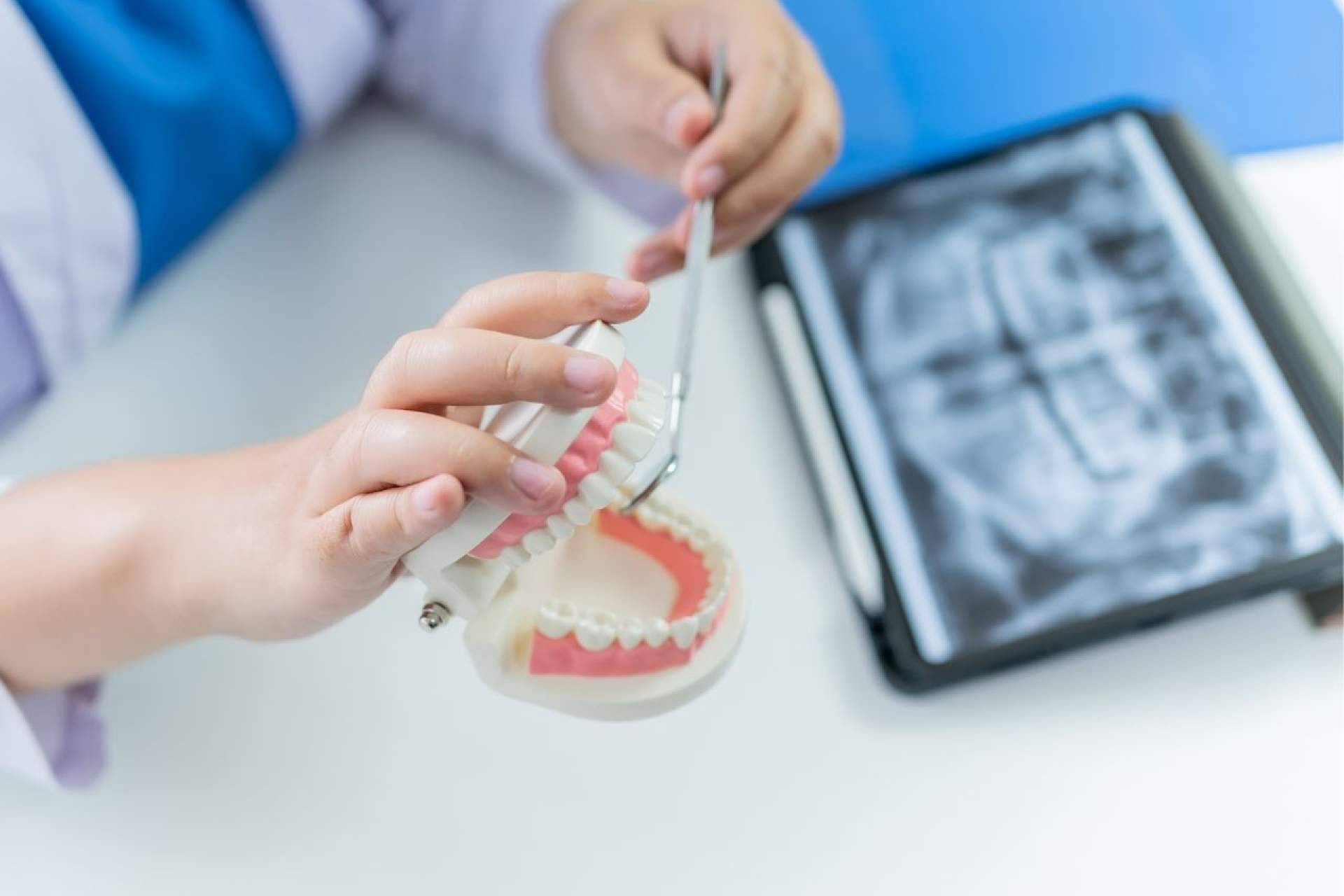 Cómo se coloca un implante dental en Málaga; Paso a paso sin dolor
