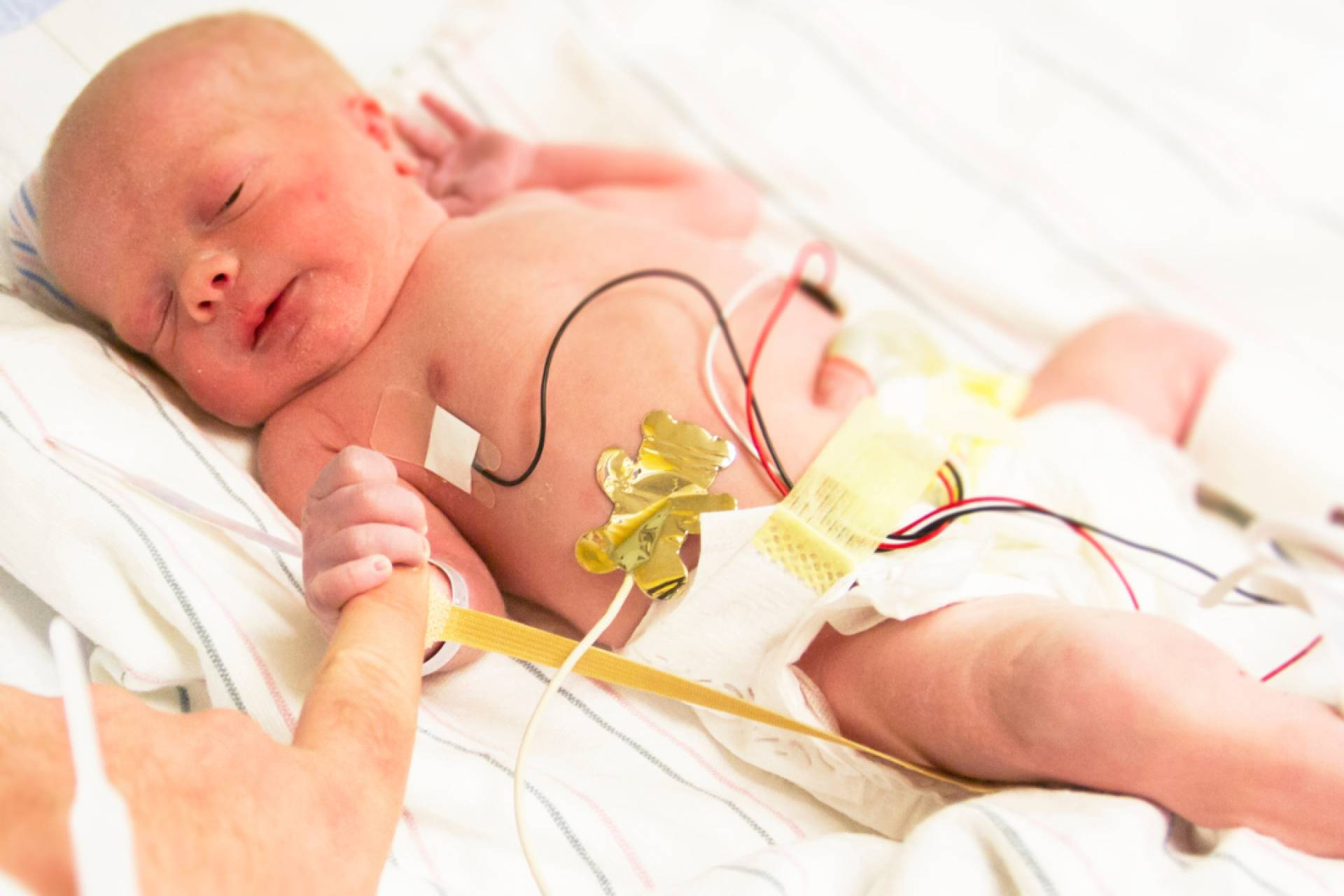 Prematuridad y acompañamiento, la experiencia de familias de bebés prematuros